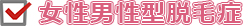 女性男性型脱毛症